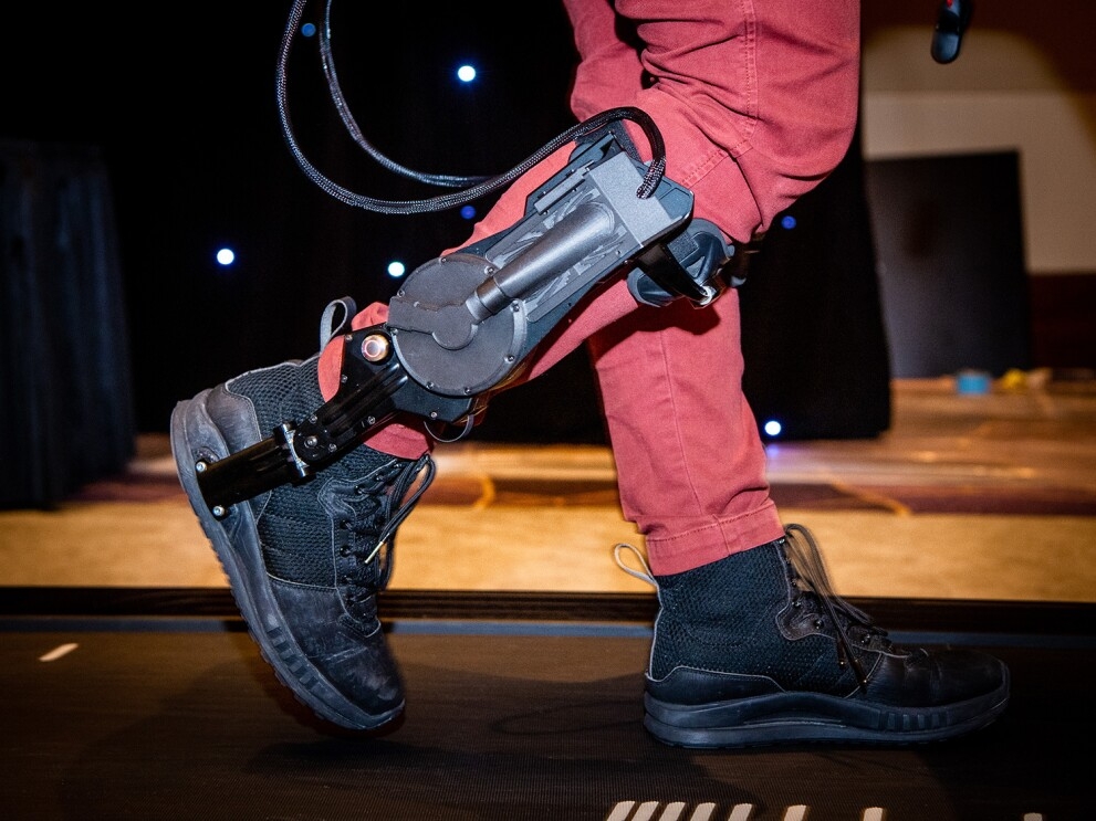 A close up image of legs walking on a treadmill with a device on the right leg.