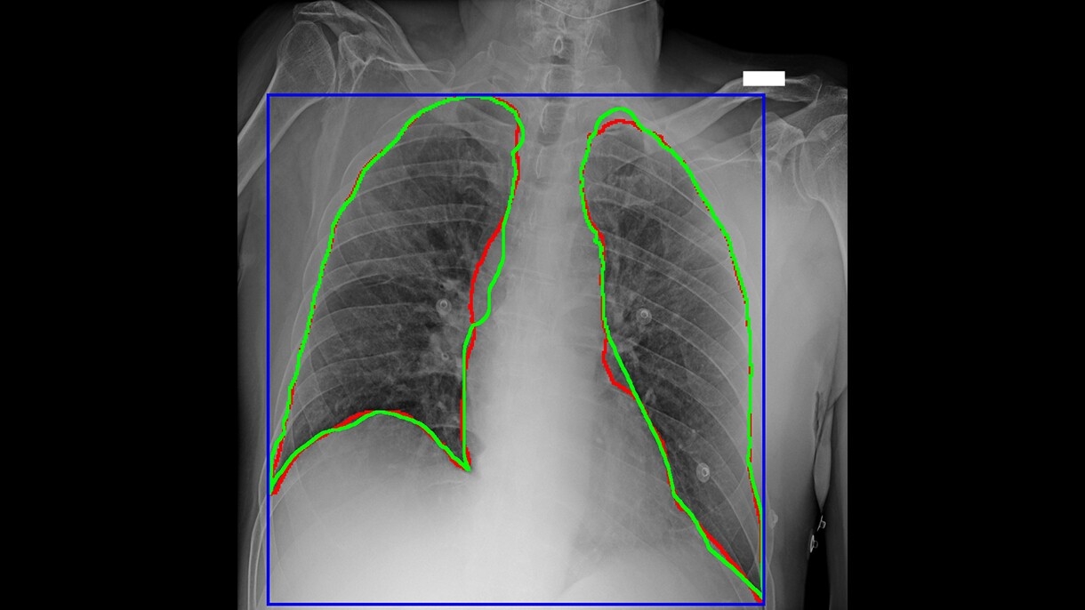 Diagnostic imagery of a lung, illustrating work as part of AWS Diagnostic Data Initiative